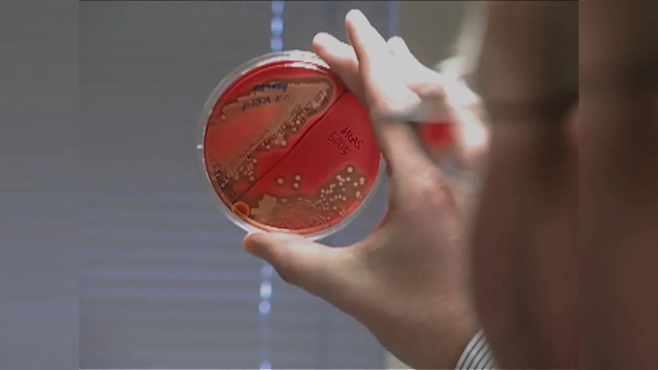 Radar – Egy karcolás is lehet halálos + videó