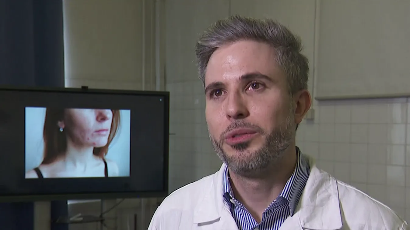 Radar – ChatGPT diagnosztizálja a bőrbetegségeket + videó