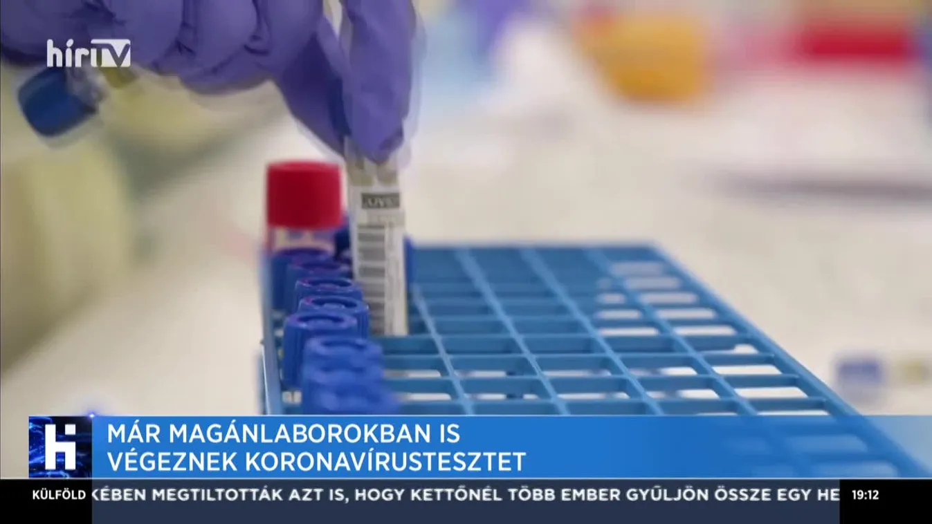 Már magánlaborban is végeznek koronavírus-tesztet