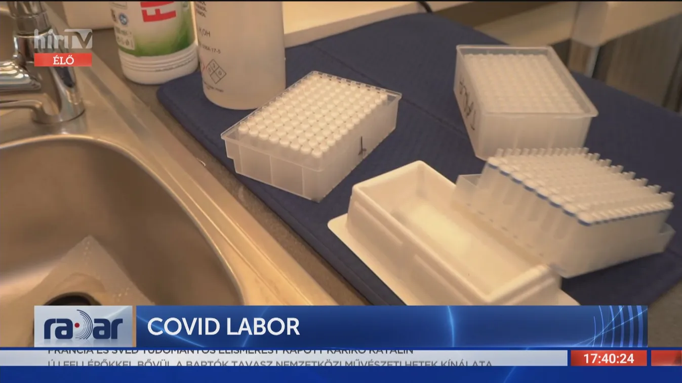 Radar: Covid labor