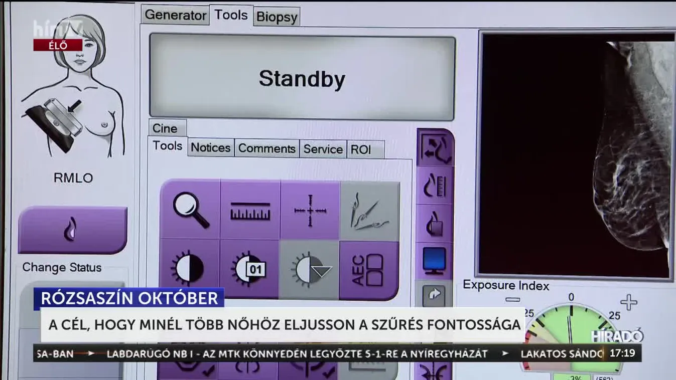 A cél, hogy minél több nőhöz eljusson a szűrés fontossága