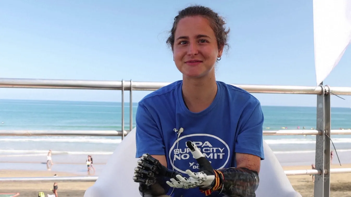 Radar - Amputált végtagokkal sem adta fel álmait