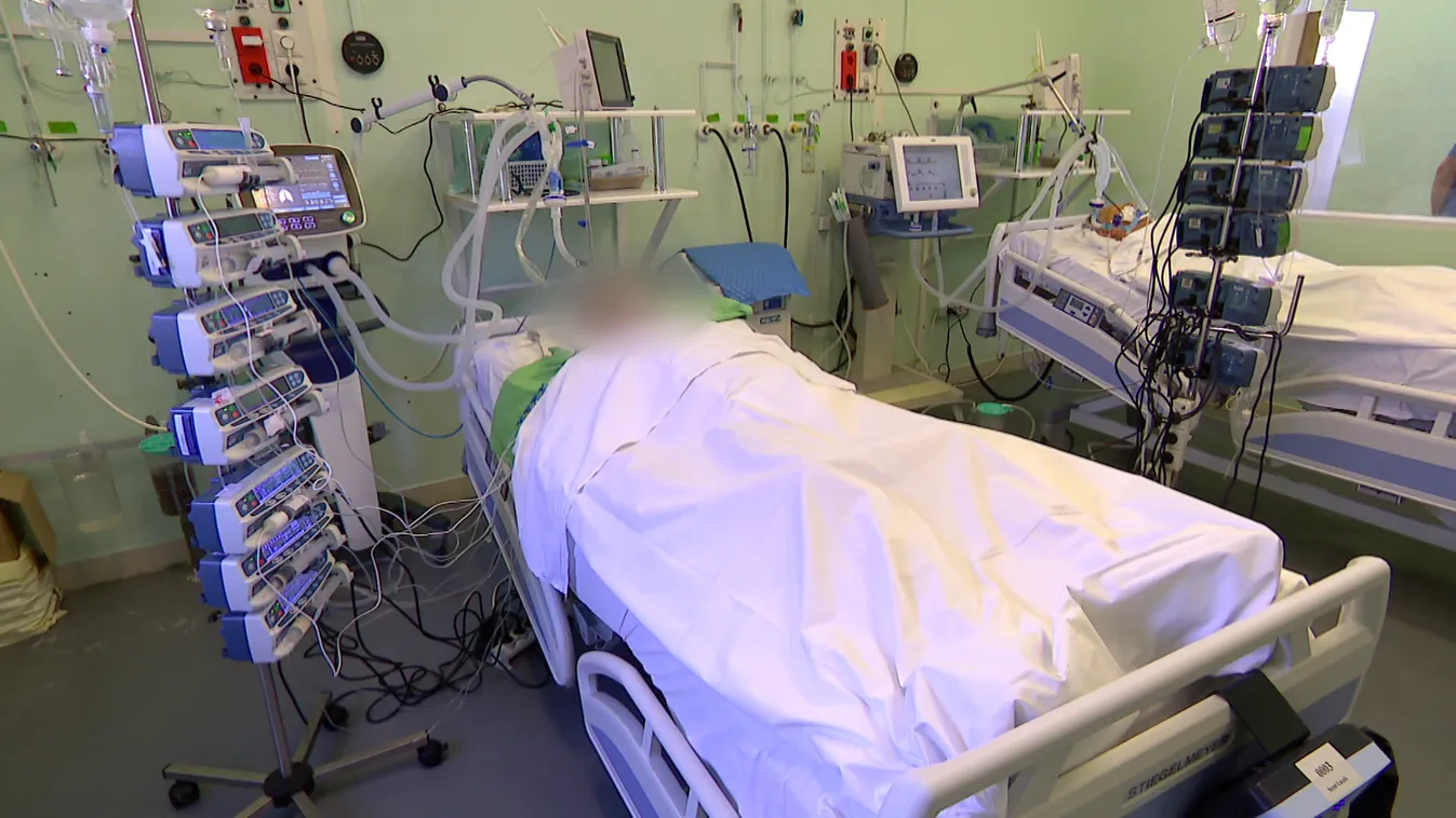 A szem- és kötőhártyagyulladás is lehet tünete a koronavírus delta variánsának