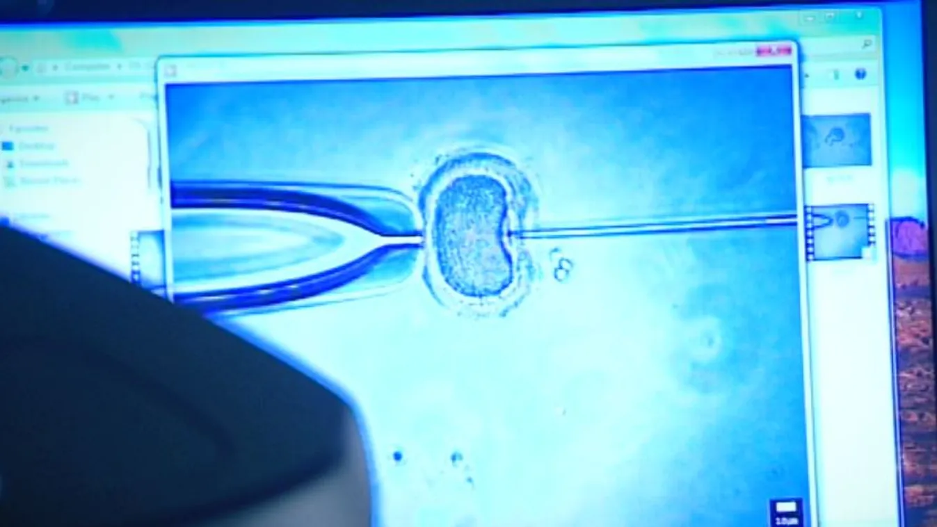 Sokkal több lombikbébi-kezelés is indulhatna