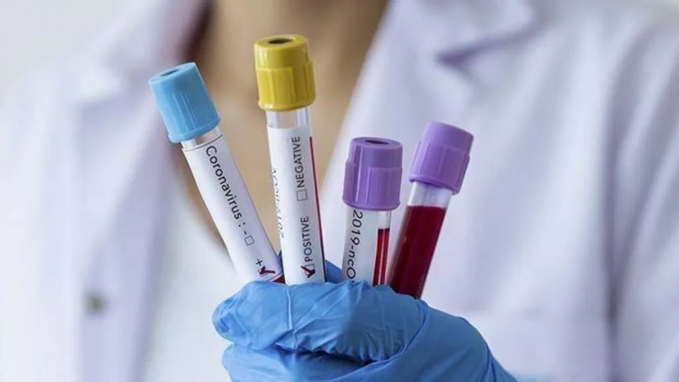 Kiegészítő szigorítások vidéken