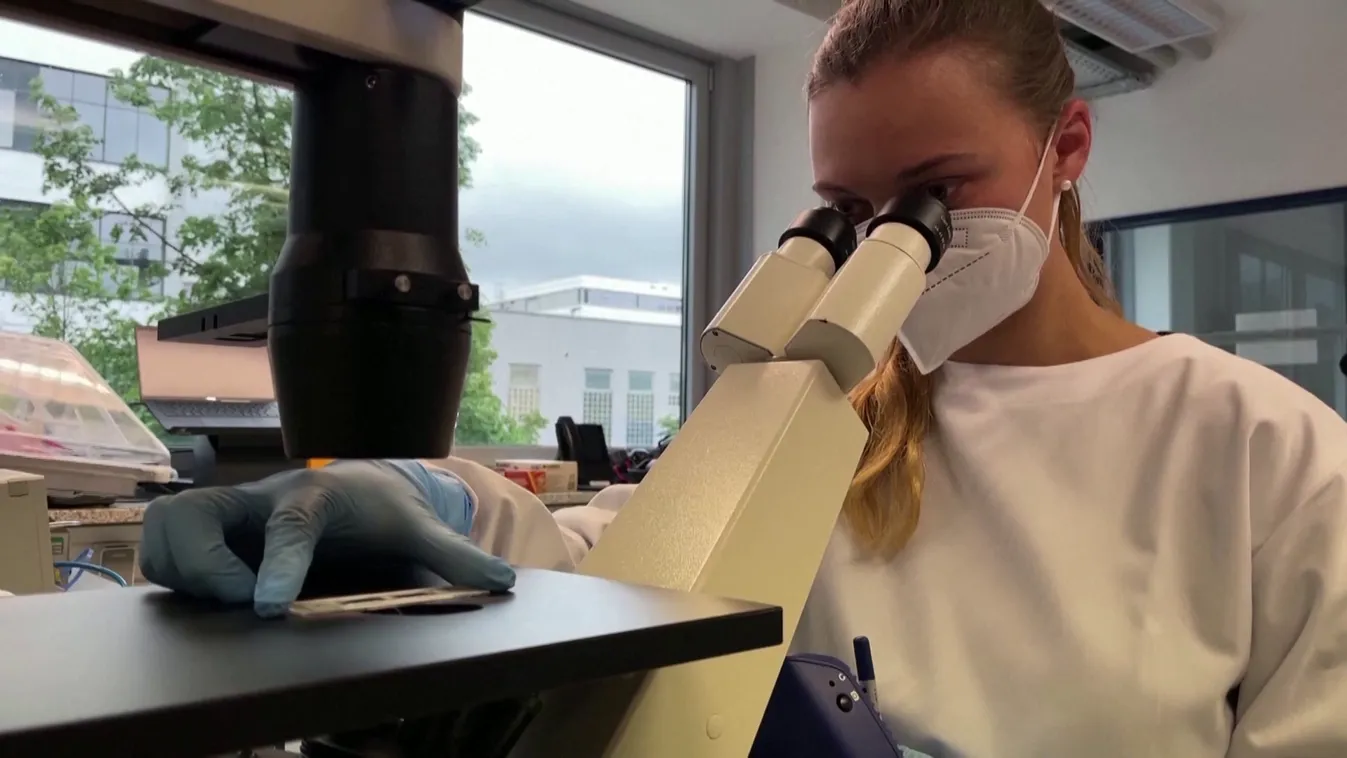 Radar - Európában is terjed a majomhímlő