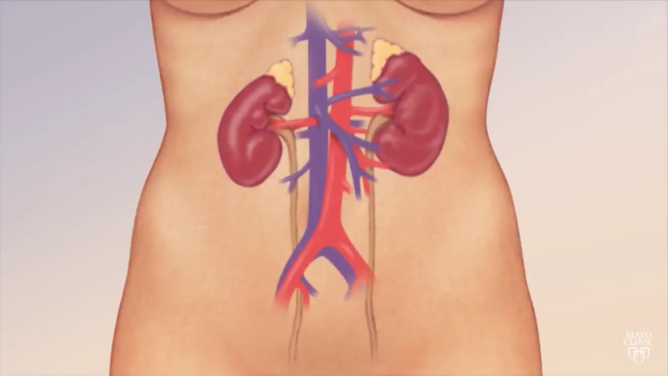 Radar- A csendes gyilkos + videó