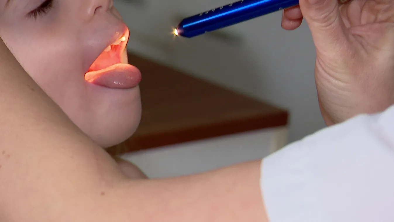 Radar - Ismét terjed a kéz-láb-száj betegség