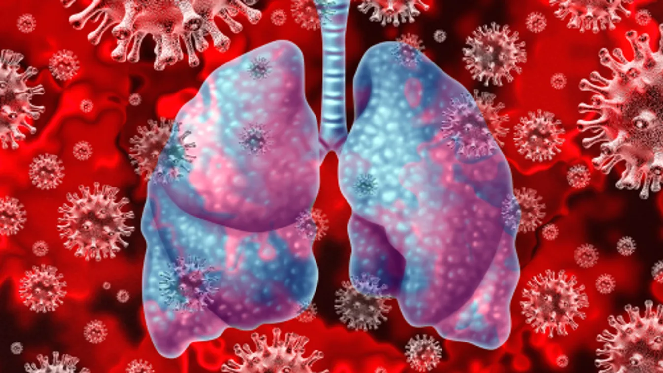 Nem javul a helyzet az Egyesült Államokban