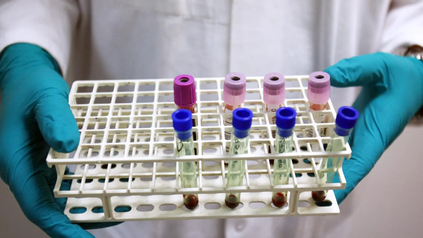 Egyes tiltott szerek mégsem tiltottak