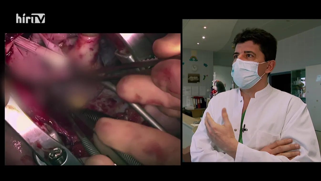 Mozaik - Egészségügyi percek