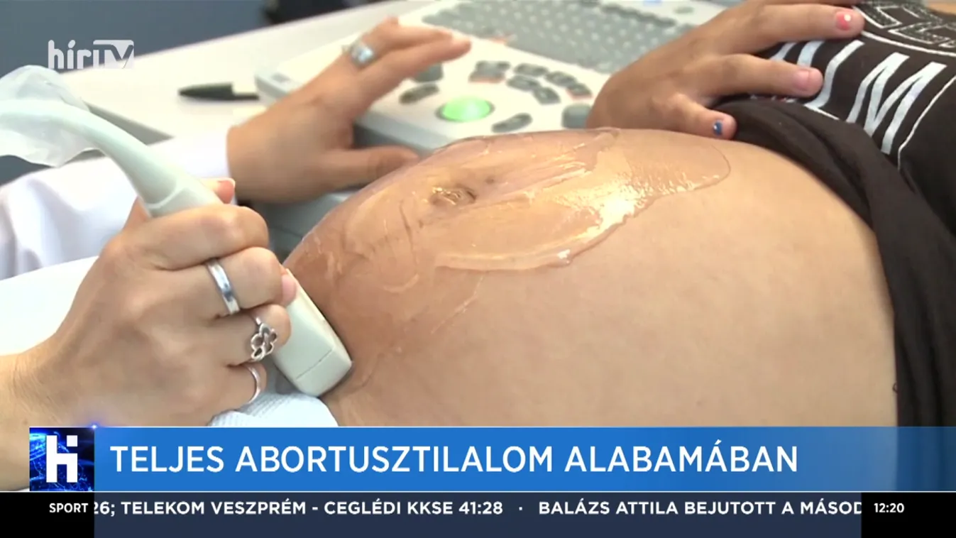 Teljes abortusztilalom Alabamában