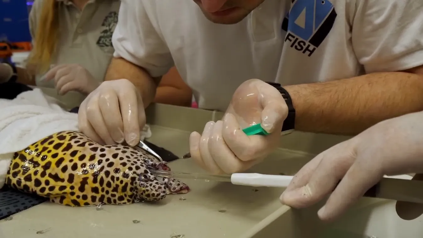 Radar - Nem mindennapi műtét Nyíregyházán