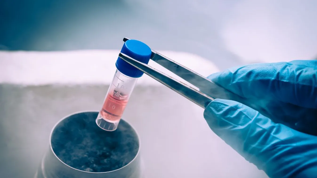 Elérhetetlenné vált az egyik magyar őssejt bank