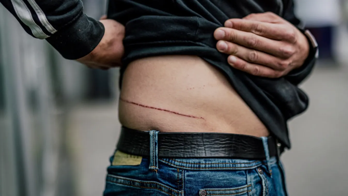 Így történt az újabb antifa támadás - váratlanul, hirtelen és sokan egy ellen