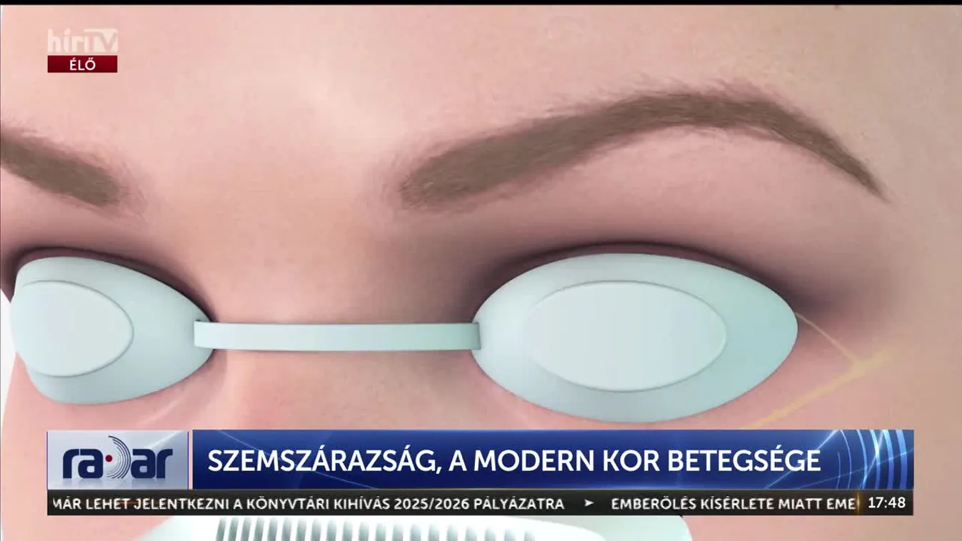 Szemszárazság a modern kor betegsége + videó