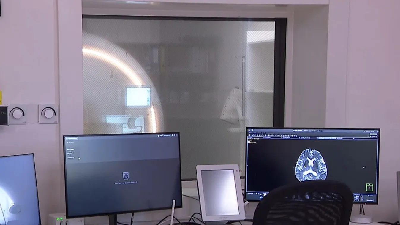 Radar – Így csökkenhet a várakozás a CT- és MR-vizsgálatokra  + videó