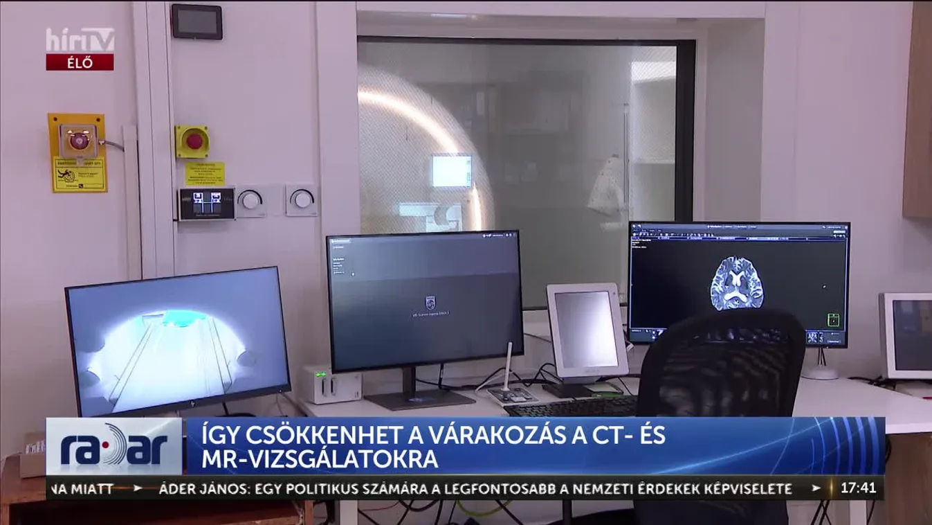 Radar – Így csökkenhet a várakozás a CT- és MR-vizsgálatokra