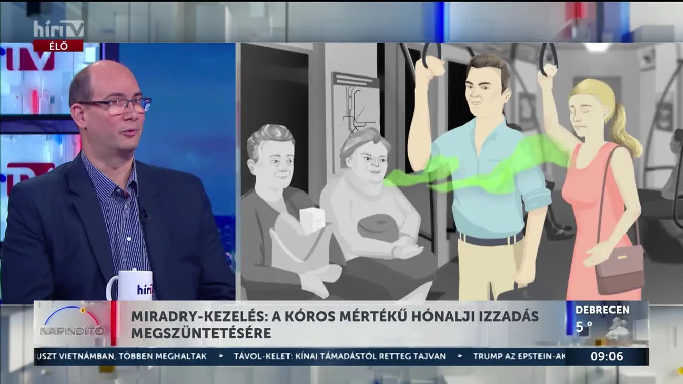 Miradry-kezelés: A kóros mértékű hónalji izzadás megszüntetésére