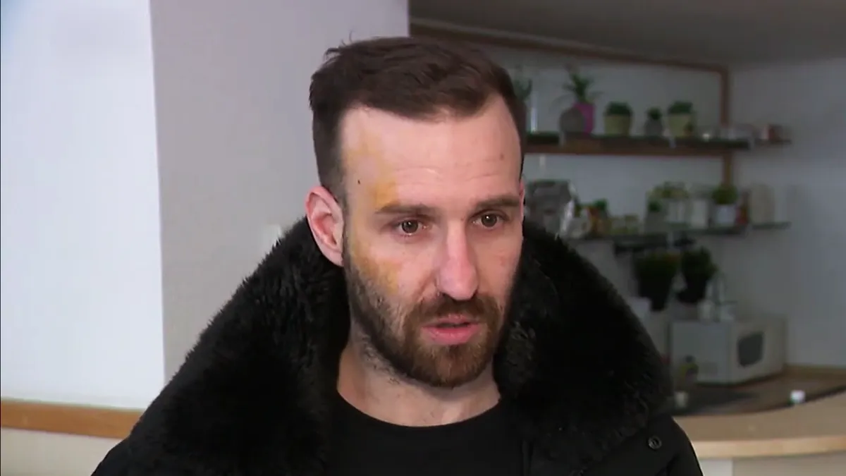 A fejét ütötték és rugdosták azt a Fidesz aktivistát, aki számon kért egy plakátrongálót ma hajnalban