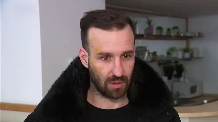 Megszólalt a megtámadott férfi, aki szóvá tette a fideszes plakátok rongálását