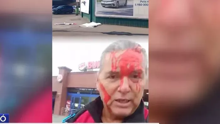 Festékkel öntöttek le Budapesten egy kormánypárti szimpatizánst