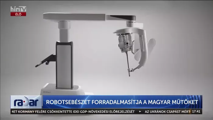Elképesztő magyar orvosi siker a robotkarokkal