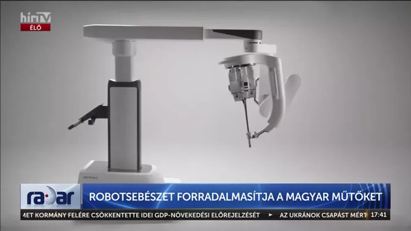 Elképesztő magyar orvosi siker a robotkarokkal