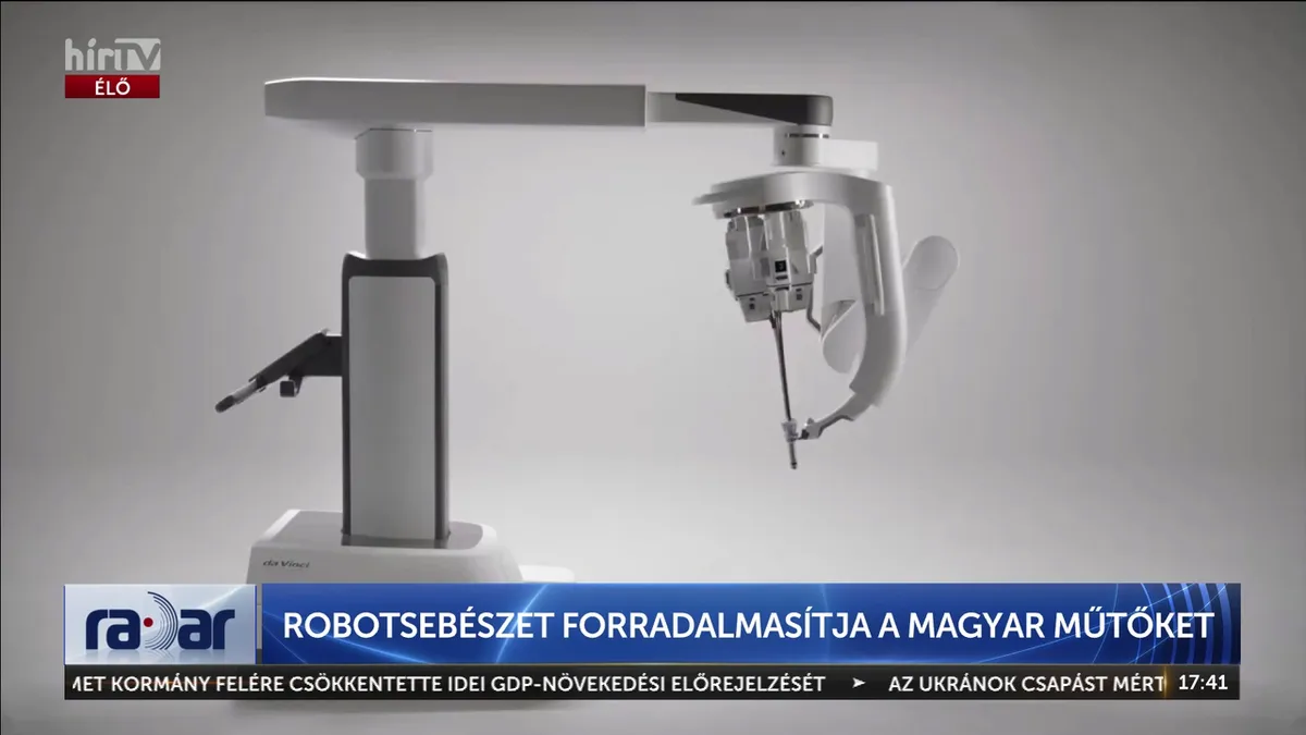 Elképesztő magyar orvosi siker a robotkarokkal