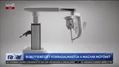 Elképesztő magyar orvosi siker a robotkarokkal