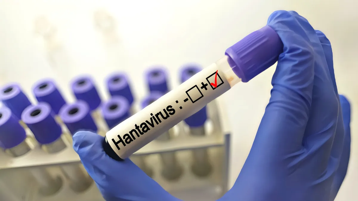 Egy olasz virológus szerint a hantavírus a globalizációval érkezett