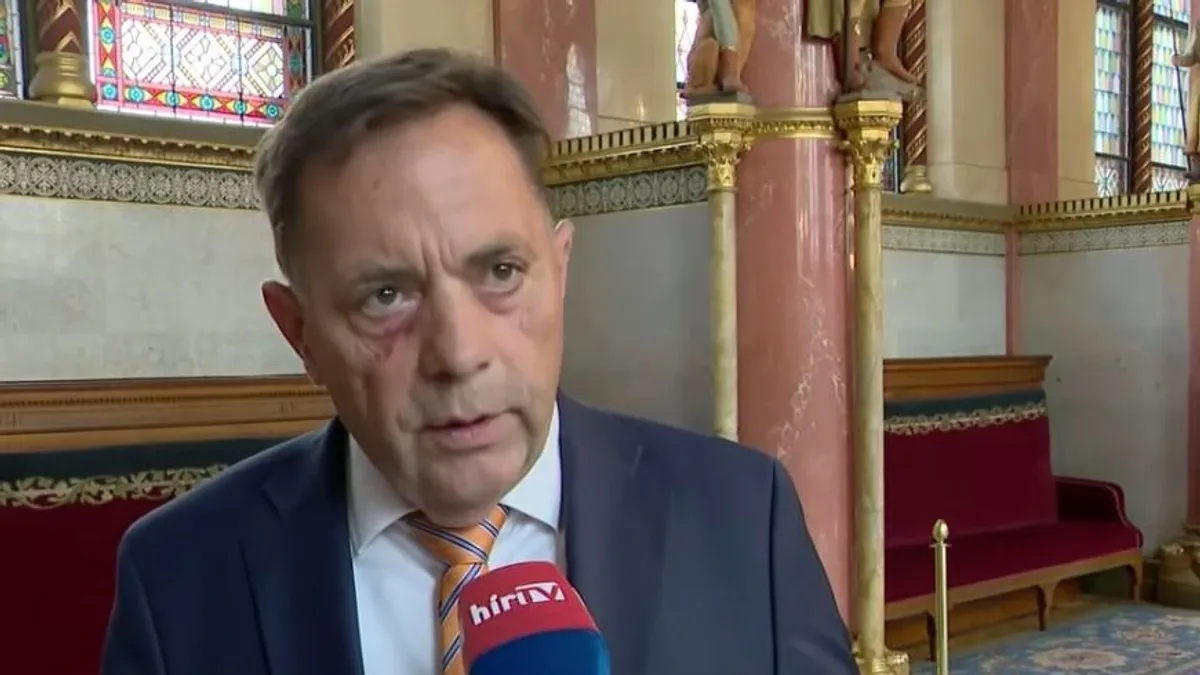 A szociális és családügyi miniszter több gyermekvédelmi vezetőt is menesztett az állásából