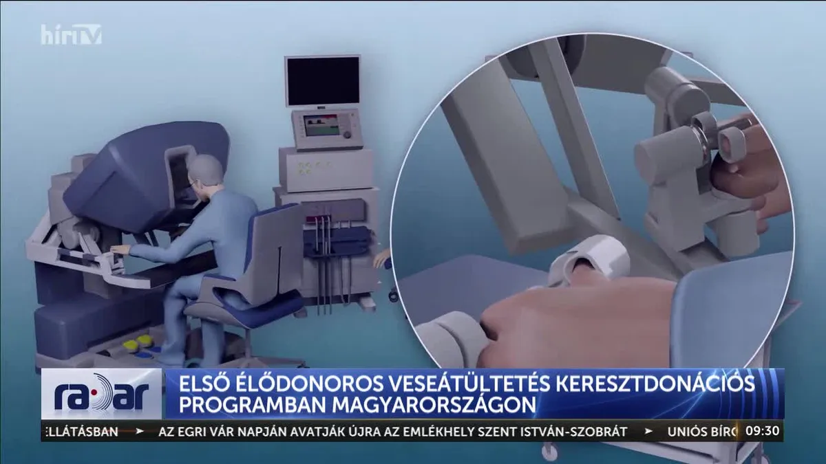 Vesetranszplantáció: Nagy mértékben lerövidülhet a várakozási idő