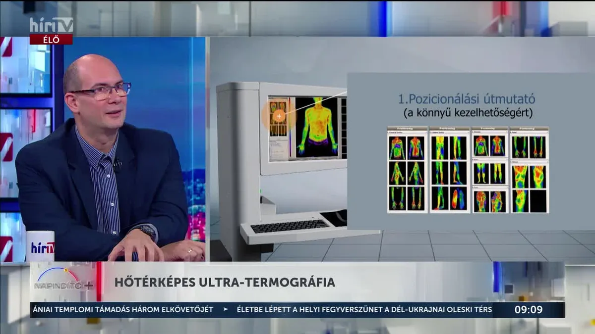 Hogy működik az ultra-termográfia?